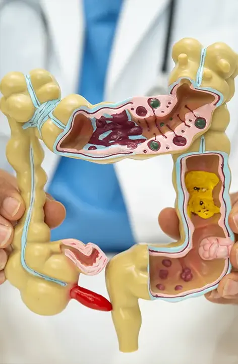 colon irritabile dottoressa linda casillo nutrizionista bastia umbra 1